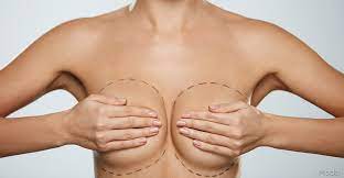 Expert Surgeons for Breast augmentation Miami in Miami post thumbnail image