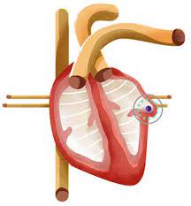 Understanding the Watchman Procedure: Safeguarding Atrial Fibrillation Patients post thumbnail image