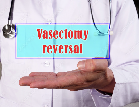 Vasectomy Reversal: Understanding Your Choices post thumbnail image